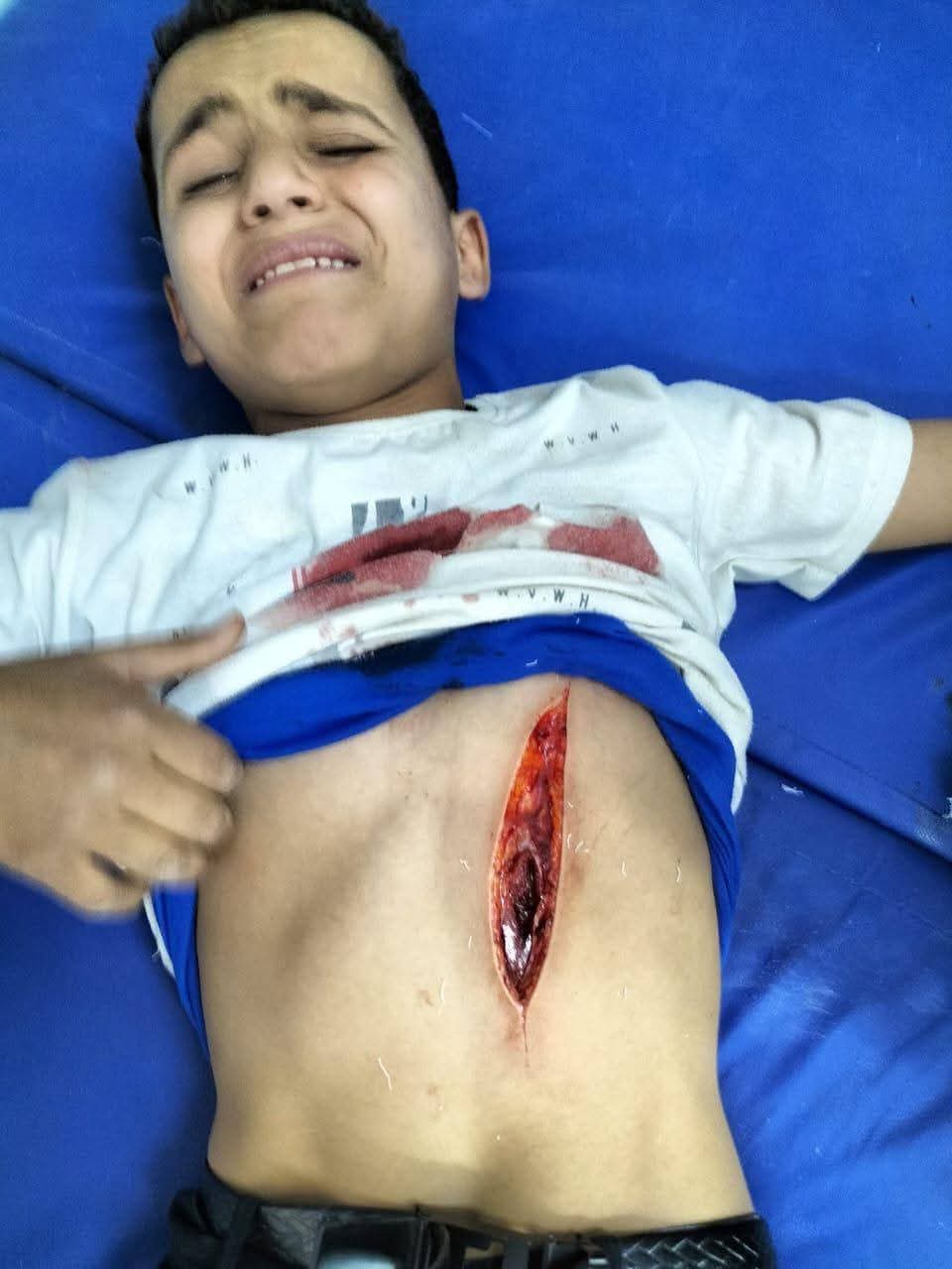 احد المصابين