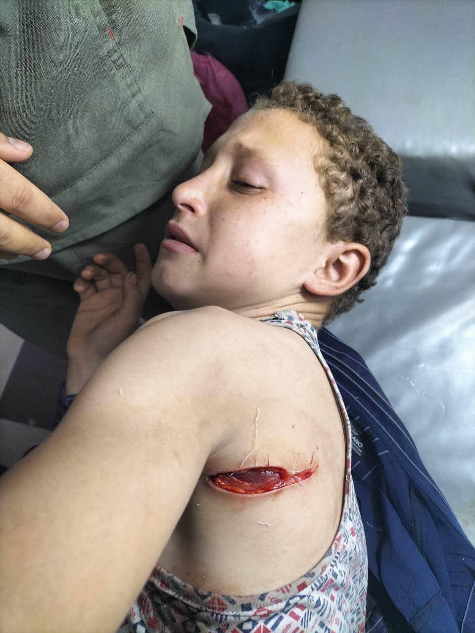 احد المصابين
