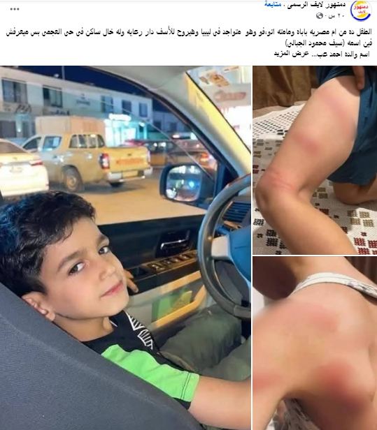 البوست المنتشر
