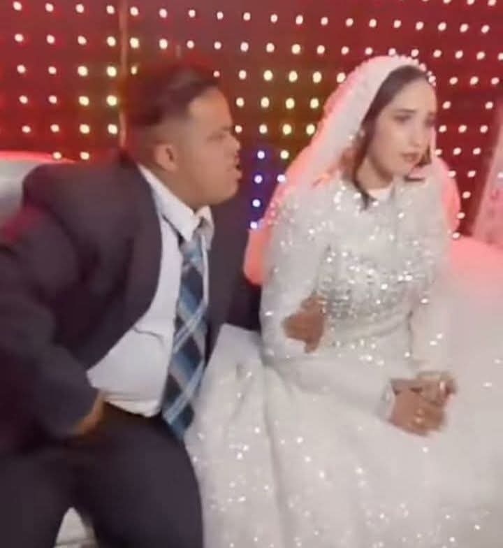 <strong>تفاصيل واقعة عريس متلازمة داون</strong>