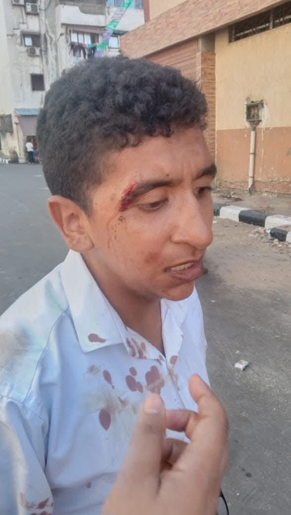 الطالب عقب الضرب وسرقة الهاتف