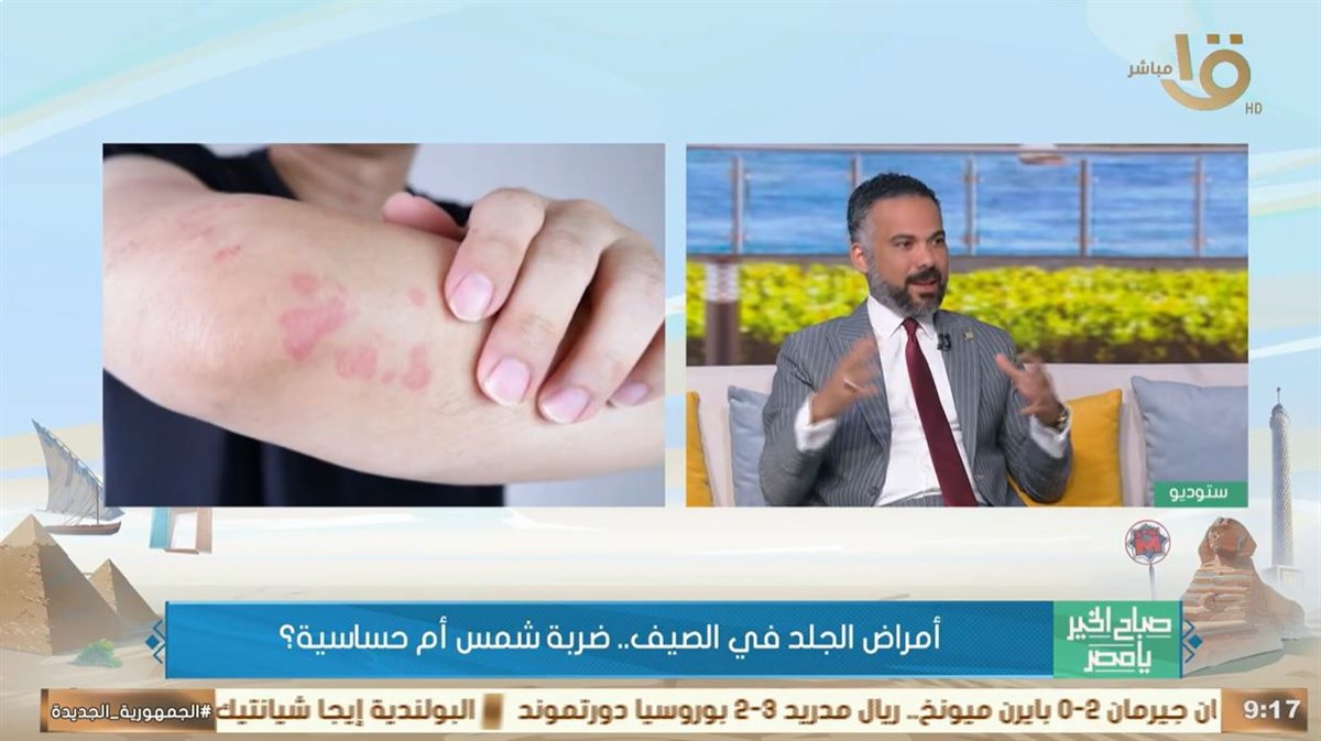 آشعة الشمس