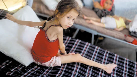 طفلة جائعة في غزة