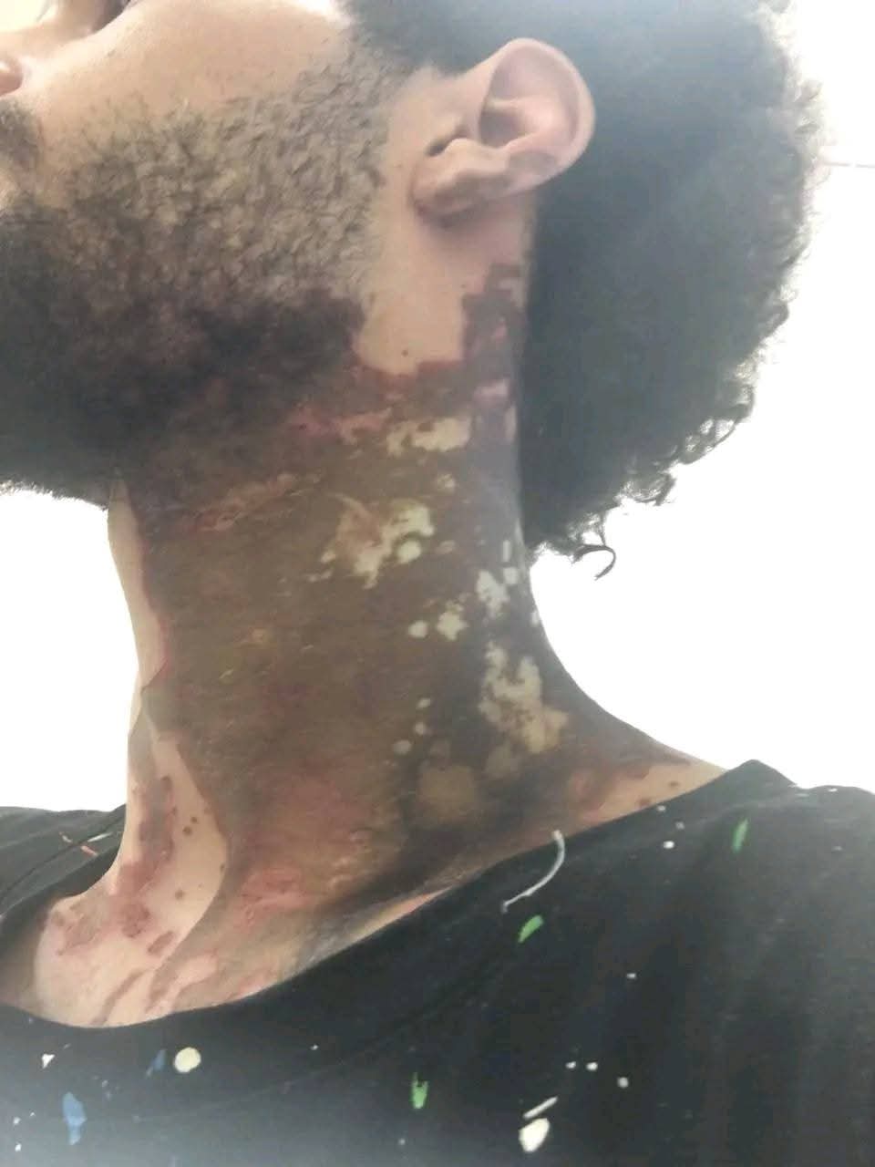 احد المصابين