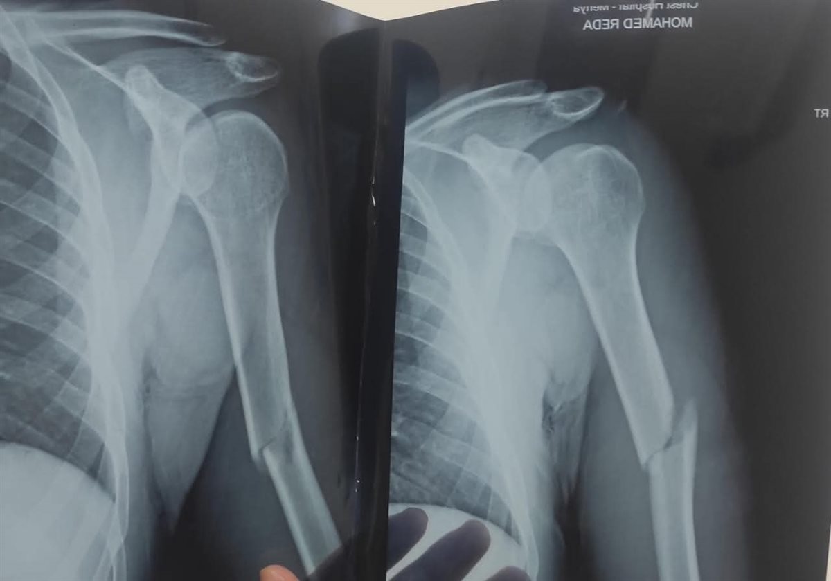 صورة من الاشعه