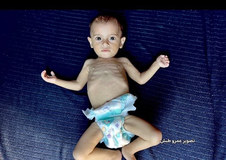 الطفلة الرضيعة وتين الندى
