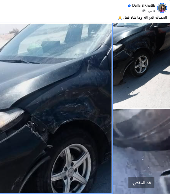 داليا الخطيب تتعرض لحادث