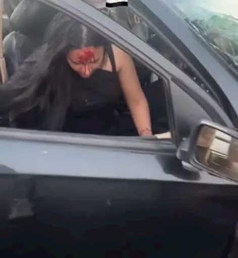 الفتاة مصابة 