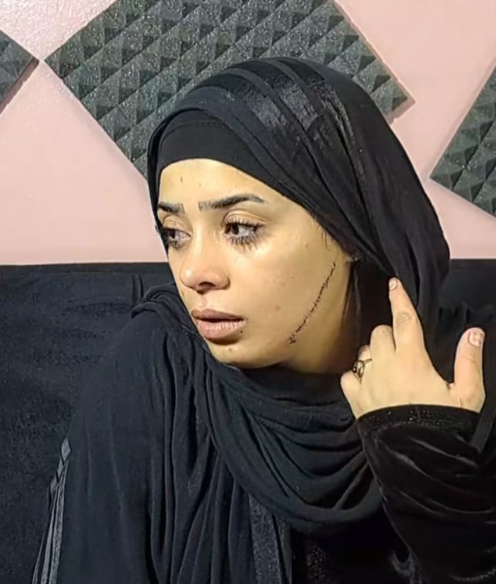 <strong>تشويه وجه
