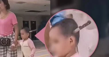 طعن صغير بسكين في رأسها