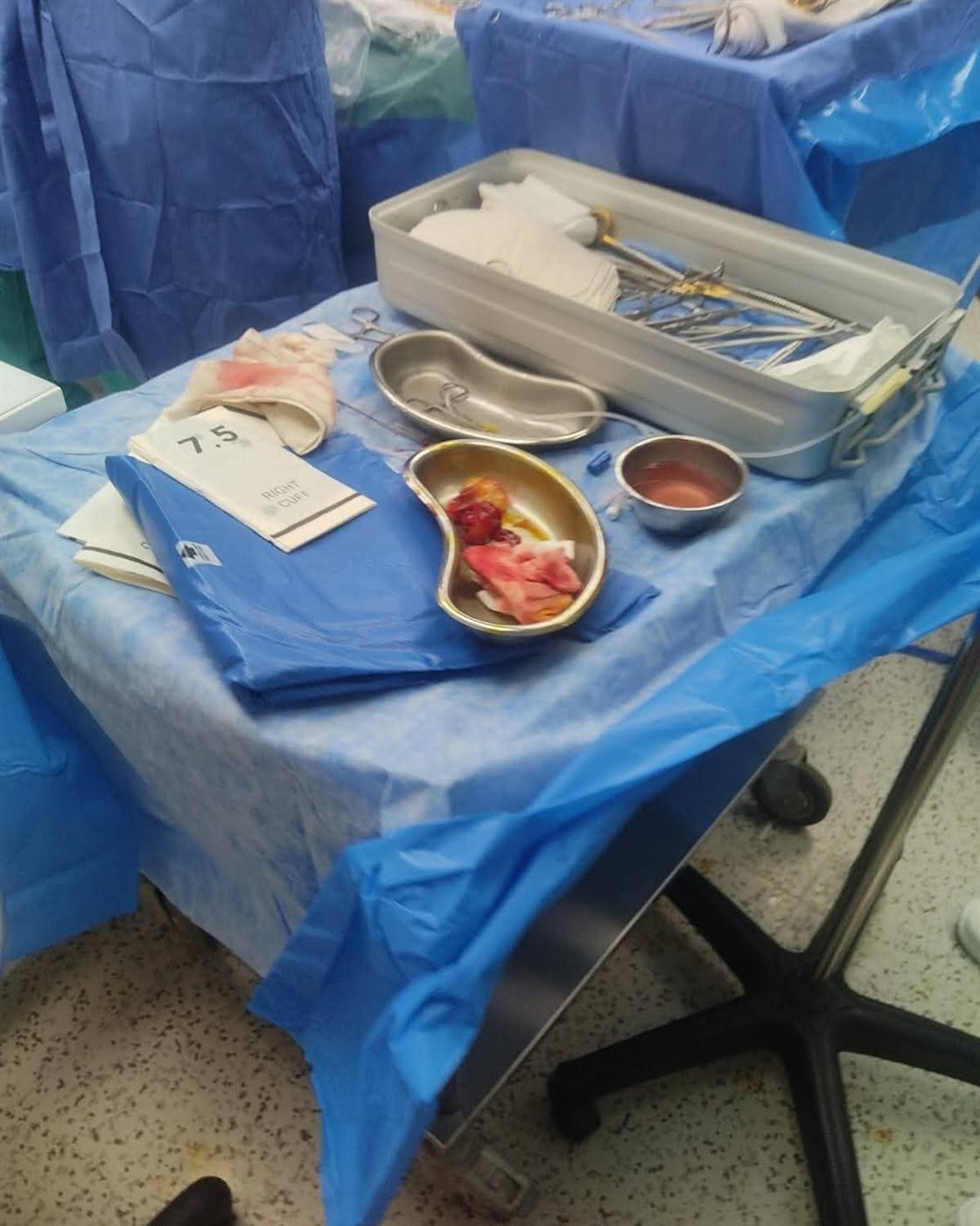 استئصال ورم بجراحة نادرة لأول مرة بمستشفي طامية المركزي بالفيوم