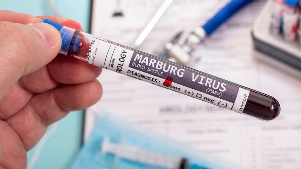 <strong>ما هو فيروس ماربورغ</strong>