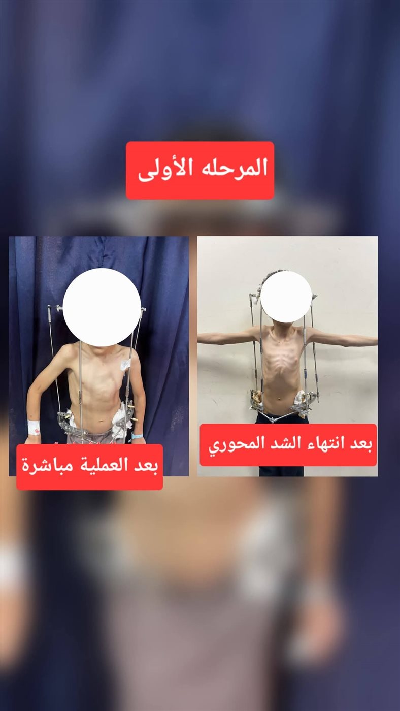 نجاح العملية الجراحية