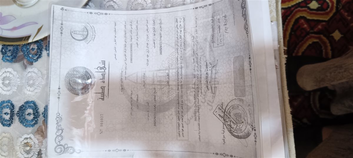 ولده طفل بالفيوم مصاب بضمور العضلات 