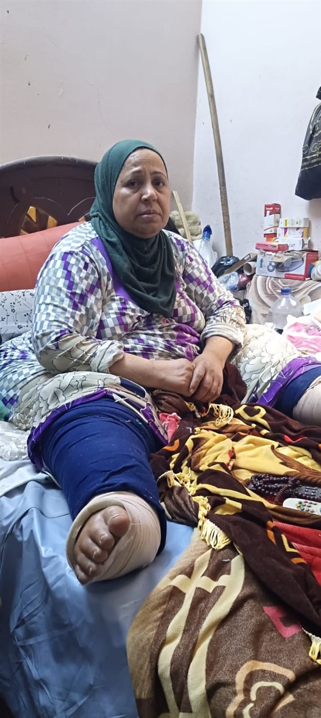 «كل حاجة بعملها على السرير».. مدام أكرام بالفيوم تستغيث بعد 8 سنوات مع داء الفيل : نفسي دكتور يتبنى حالتي