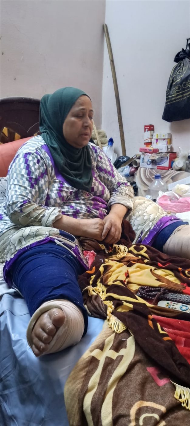 «كل حاجة بعملها على السرير».. مدام أكرام بالفيوم تستغيث بعد 8 سنوات مع داء الفيل : نفسي دكتور يتبنى حالتي