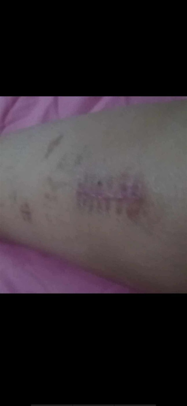 محاكمة المتهم بإصابة محررة صحفية بحادث الـ
