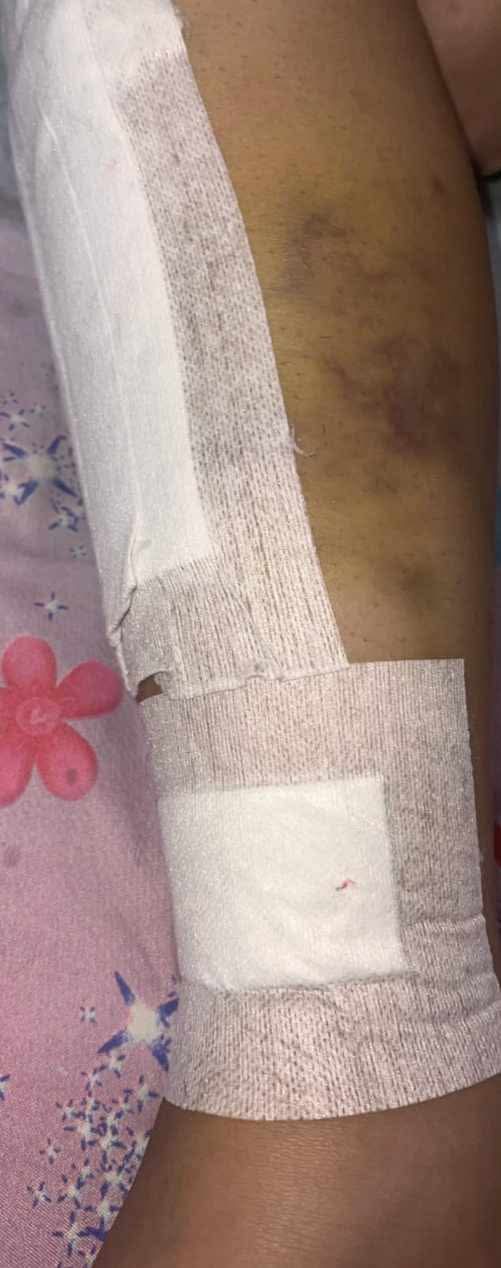محاكمة المتهم بإصابة محررة صحفية بحادث الـ
