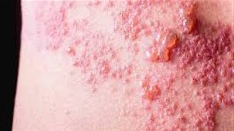 الأمراض الجلدية