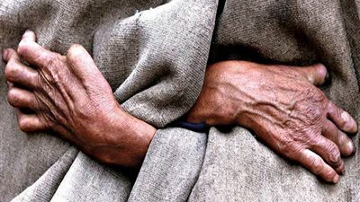 ما هو أصل مرض الجذام والدول المنتشر بها وكيفية علاجه؟