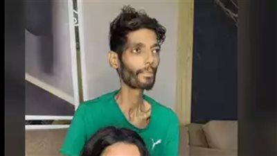 تامر حسني يتكفل حالته... ما هو مرض إبراهيم شيكا الخطير؟