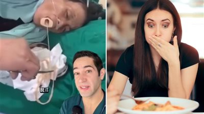 لقطات مروعة لاستخراج دودة شريطية ضخمة من فم امرأة... اعرف سبب الإصابة