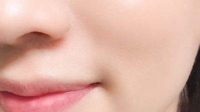 علاج حب الشباب للبشرة الدهنية والحساسة طبيعيًا بدون مجهود