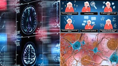 بسبب البروتينات السامة.. تفوق النساء على الرجال في الإصابة بـ