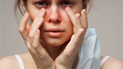 تحلل البشرة السُمي.. حالة نادرة وخطرة تُعالج بنجاح في مستشفى حورس بالأقصر