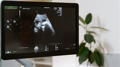 الإفتاء: الكشف المهبلي في نهار رمضان مسألة خلافية (فيديو)