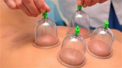 الحجامة ونقل الدم أثناء الصيام.. هل يُفسدان الصوم؟.. دار الإفتاء تُوضح الحكم الشرعي