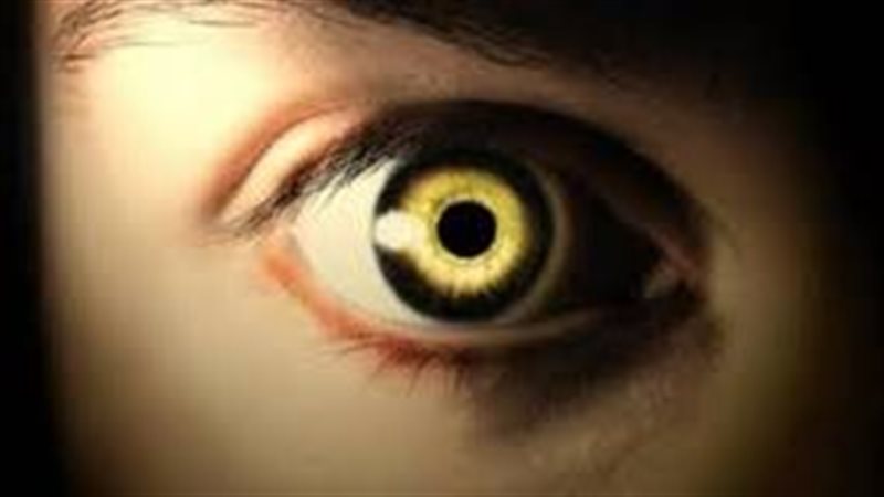 الكذب خوفا من الحسد