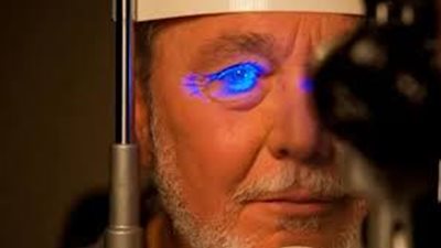 دراسة: مكملات فيتامين «B» و«الكولين» قد تبطئ تطور الجلوكوما