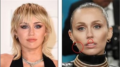 «بشفاه مرفوعة وأعين مسحوبة ».. مايلي سايرس تثير الجدل علي مواقع التواصل