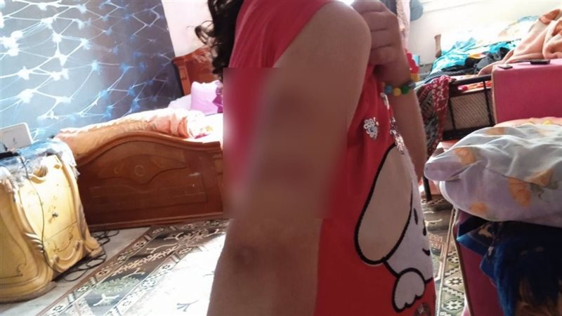 الفتاة بعد التعذيب