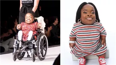 منها أقصر عارضة في 