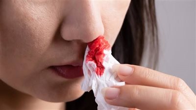 في موجة الحر.. كيف تتعامل مع نزيف الأنف في فصل الصيف؟