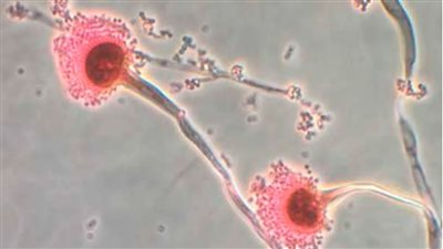 احذر ذلك الفطر .. قاتل وينتشر مع ارتفاع درجات الحرارة |تفاصيل