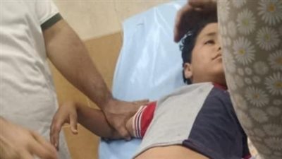 إصابة طفل في حادث سقوط من شجرة بقرية المشرك بالفيوم