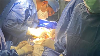 فريق جراحة الفيوم يزيل جسمًا غريبًا من 