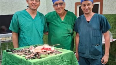 فريق طبي بمستشفى الدلنجات ينجح فى استئصال كُلى متوقفة بإستخدام منظار البطن 