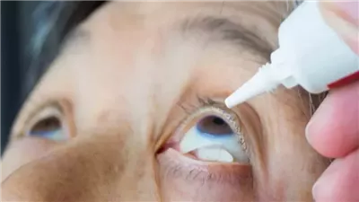 هل تعاني من جفاف العين؟ إليك الأسباب والعلاجات الفعالة