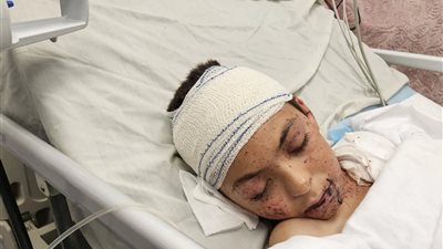 إيطاليا تتكفل بعلاج «الطفل الناجي» من أبناء الطبيبة آلاء النجار 