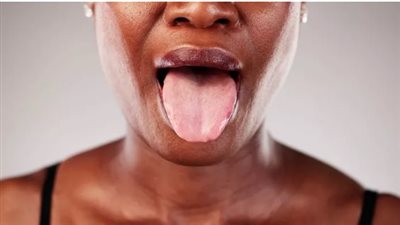 لسان أوزمبيك يطارد الحالمين بالوزن المثالى.. ما القصة ؟  