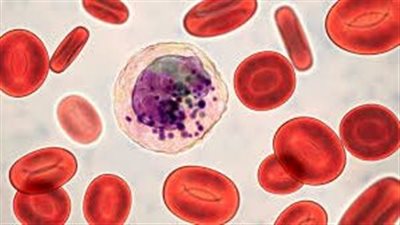 هل تقلل أدوية الستاتين خطر الوفاة بسرطان الدم؟ دراسة حديثة تجيب