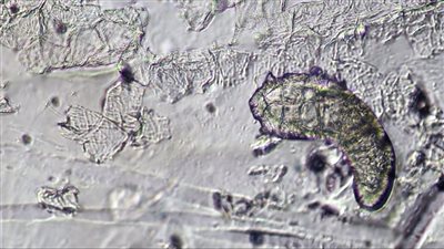 أثناء نومك تقوم هذه الحشرات بإقامة حفلة على وجهك..تفاصيل