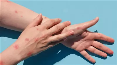 ظهور بقع على الجلد يشير لأمراض خطيرة.. متى تستشير الطبيب؟