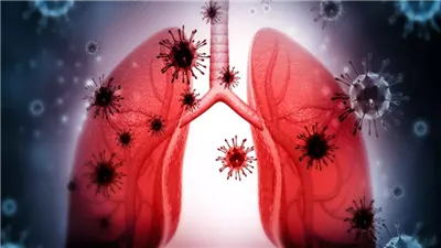 استشاري الحساسية والمناعة يحذر من الاستخدام العشوائي للمضادات الحيوية