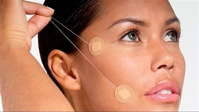 خيوط التجميل الحل السحري لإخفاء التجاعيد قبل العيد