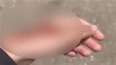 ادعاء كاذب يثير الذعر.. فتاة تختلق محاولة اختطاف بحقنة مخدرة